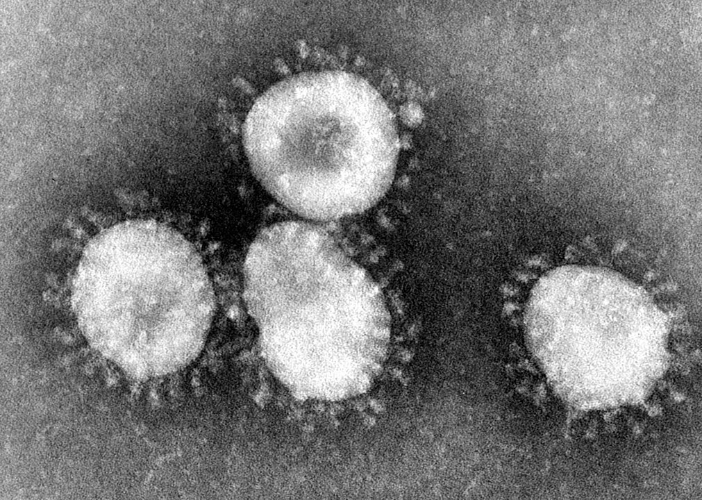 Coronaviruses are a group of viruses that have a halo, or crown-like (corona) appearance when viewed under an electron microscope. The coronavirus is now recognized as the etiologic agent of the 2003 SARS outbreak.